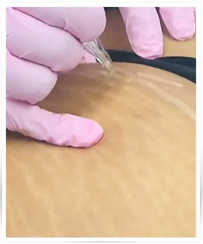 Para Quem é o Curso Camuflagem de Estrias